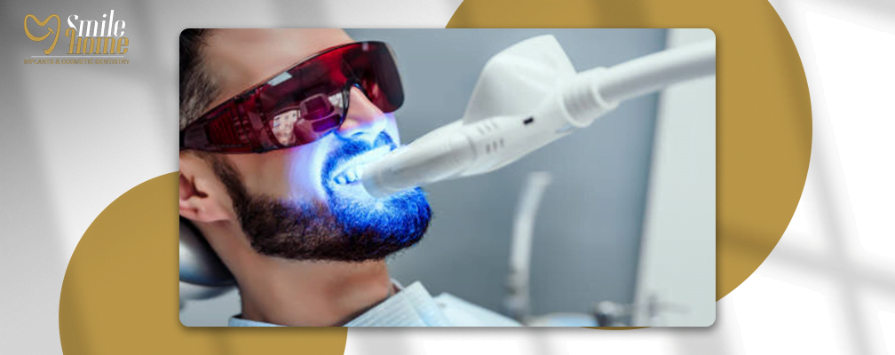 سعر تبييض الاسنان بالليزر فى مصر
