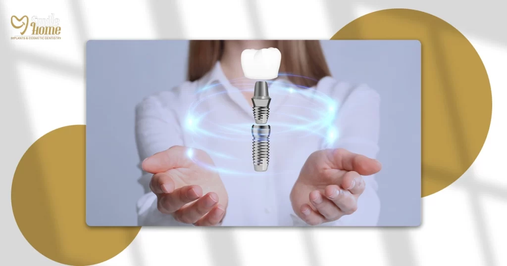 أفضل أنواع زراعة الأسنان عالمياً