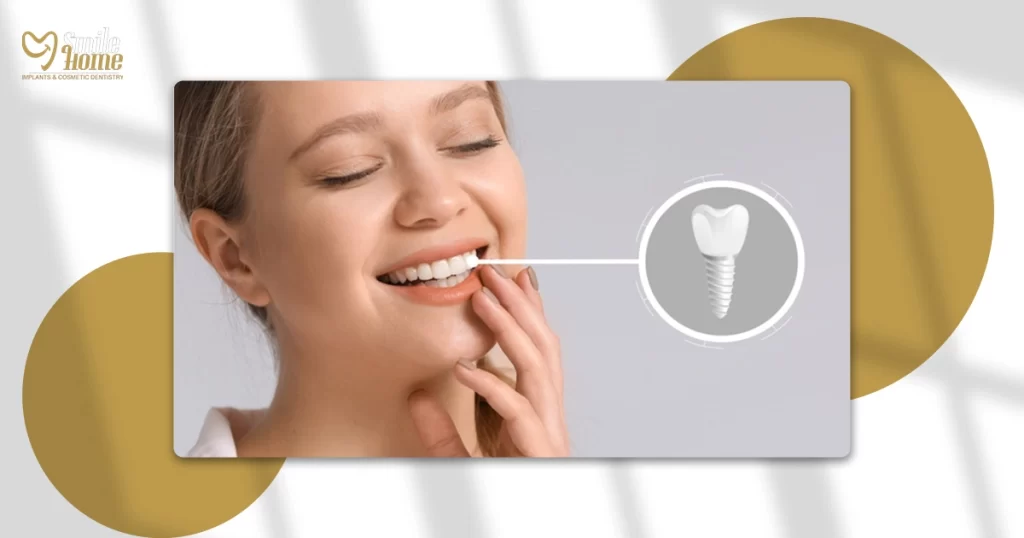 اسعار زراعة الاسنان الفورية في مصر