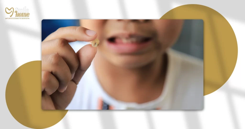 ماذا بعد تآكل مينا الأسنان؟