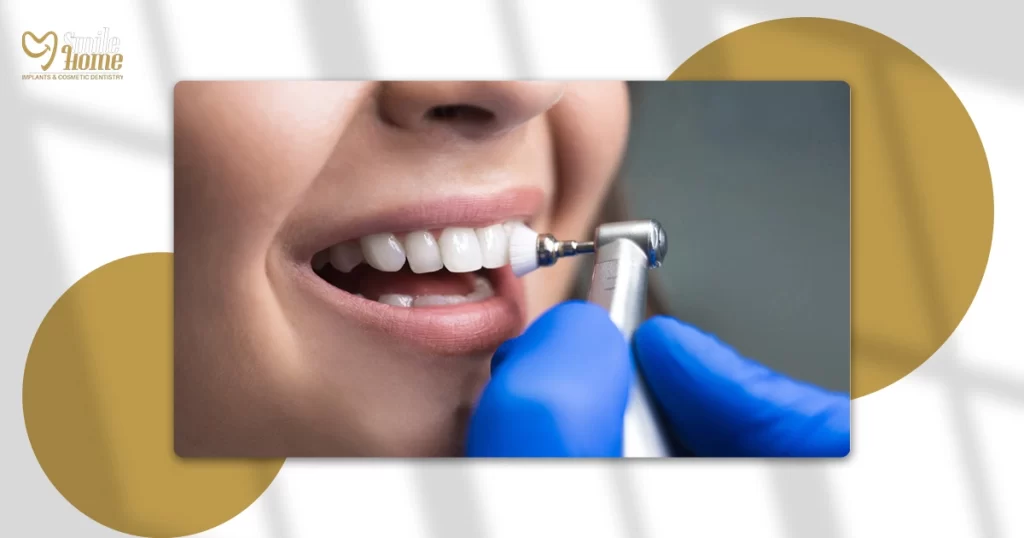 الفرق بين تنظيف اللثة وتنظيف الأسنان