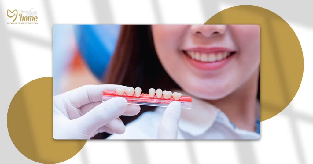 أنواع طربوش الأسنان واسعارها