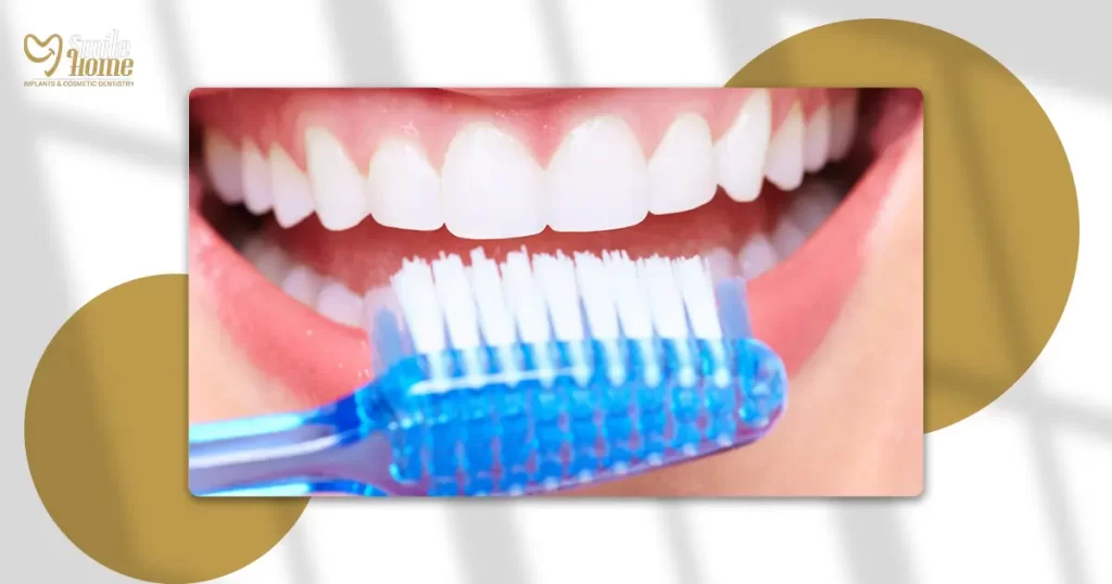 طريقة تنظيف الأسنان التركيب الثابتة